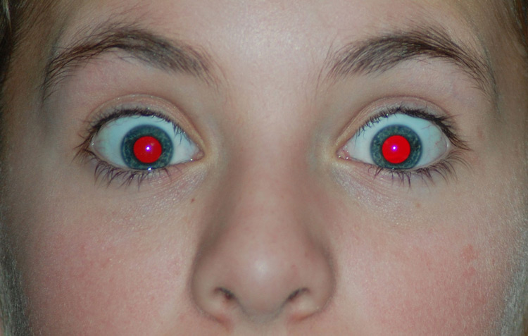 photography terms: red eye example photo